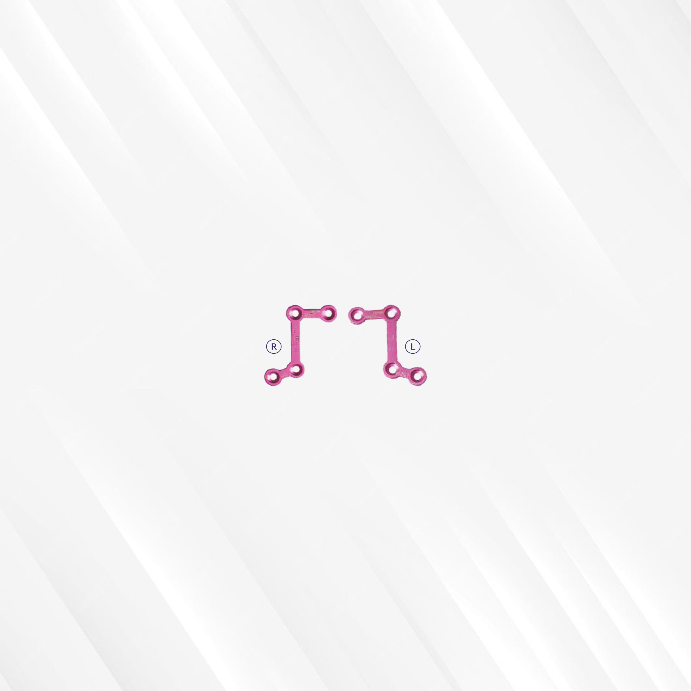 Z Shape Recon Plates