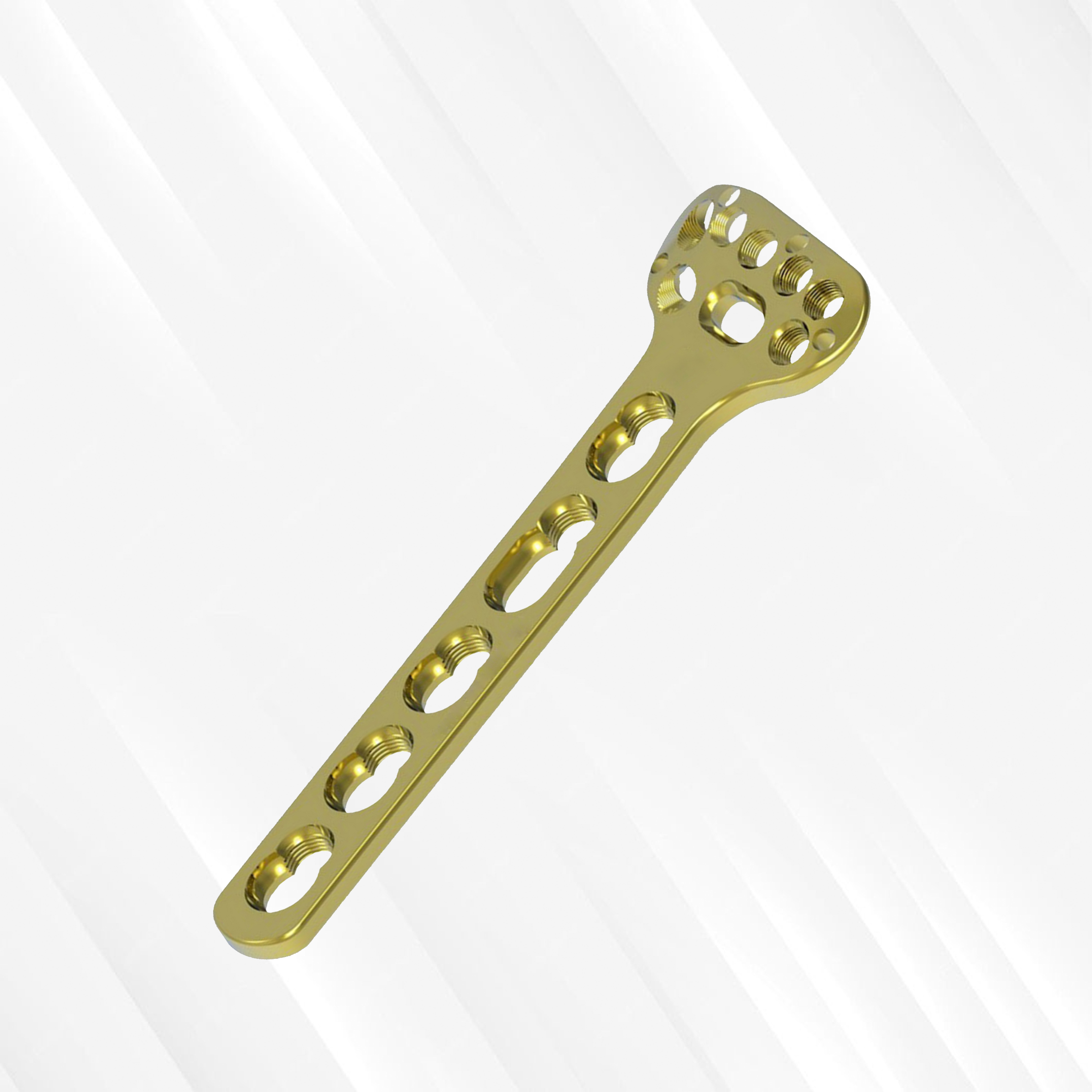 2.7 / 3.5 mm Peri - Lock Volar Distal Radius Locking Plate